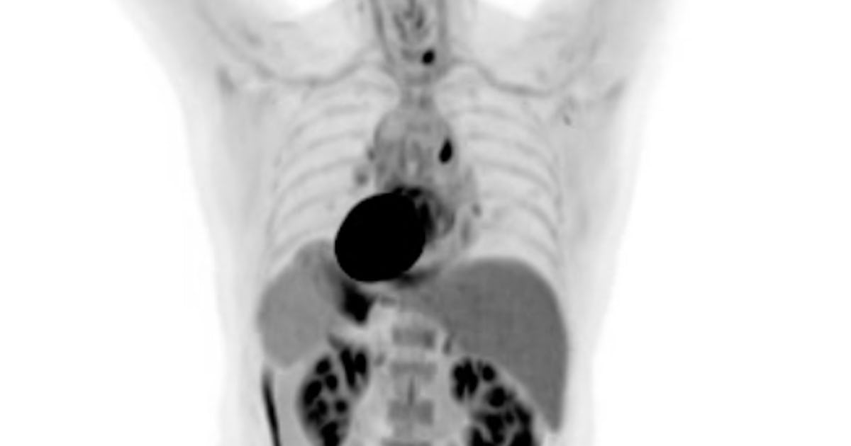 Video Shows How First