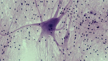 Nervous Tissue: Spinal Cord Motor Neuron