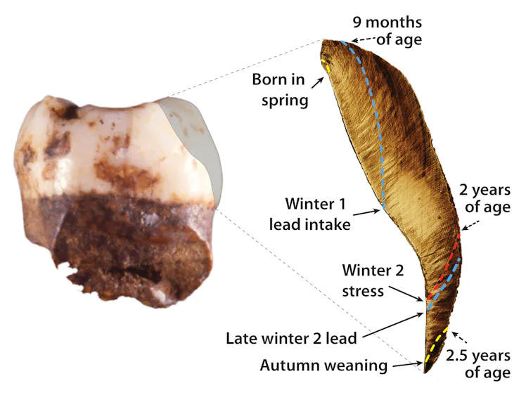 Bussel Teeth Neanderthals: