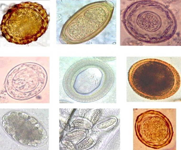 Яйца гельминтов микроскопия