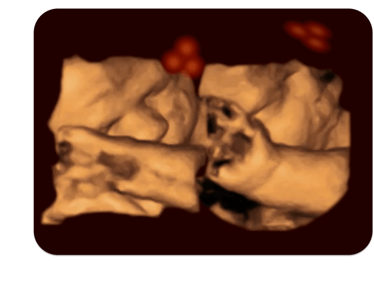 4D fetus