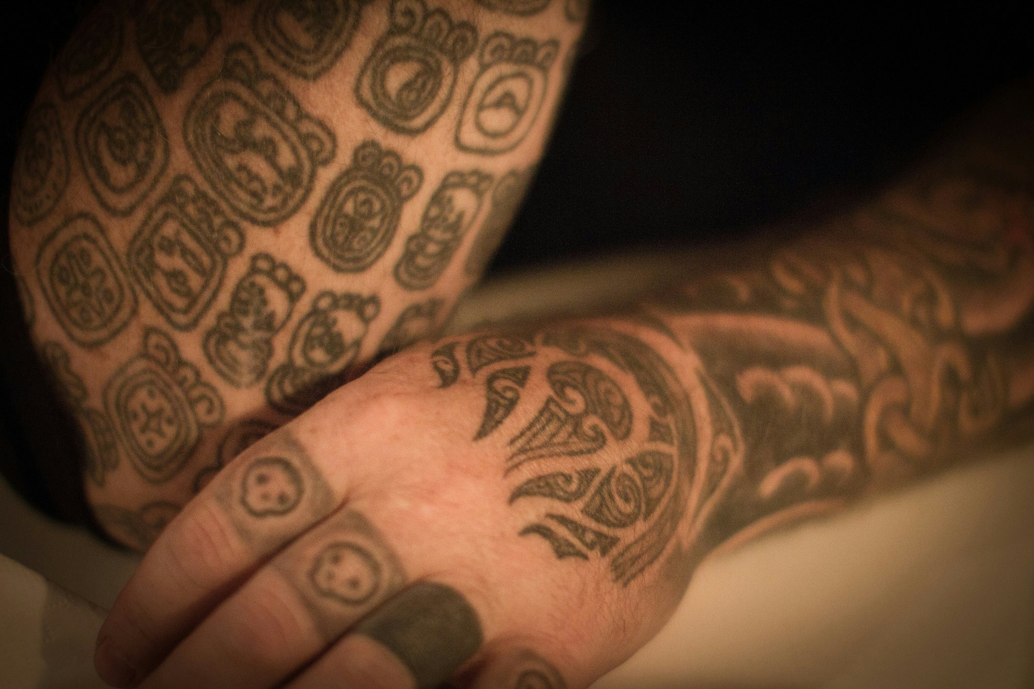 More Indians opt for tattoo removal