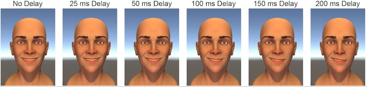 smile symmetry delay facial paralysis rehabilitation