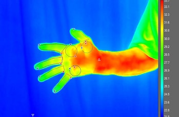 A thermal image of a participant's palm taken during the study.