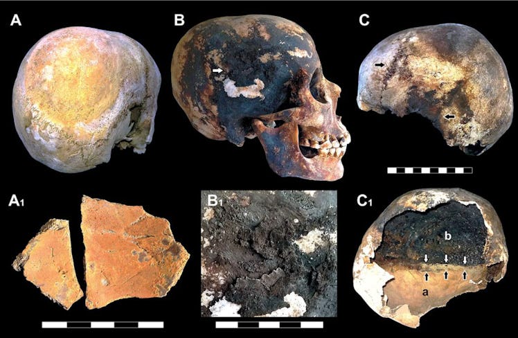Dark stains and char marks tell researchers that Vesuvius' victims' brains likely vaporized in their...