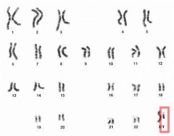 Chromosome Y in red, next to the much larger X chromosome.