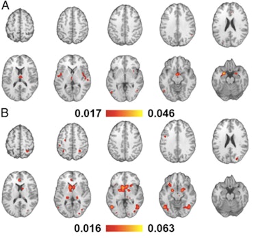 Brain activation looked different depending on whether a person viewed videos (A) or photos (B), but...