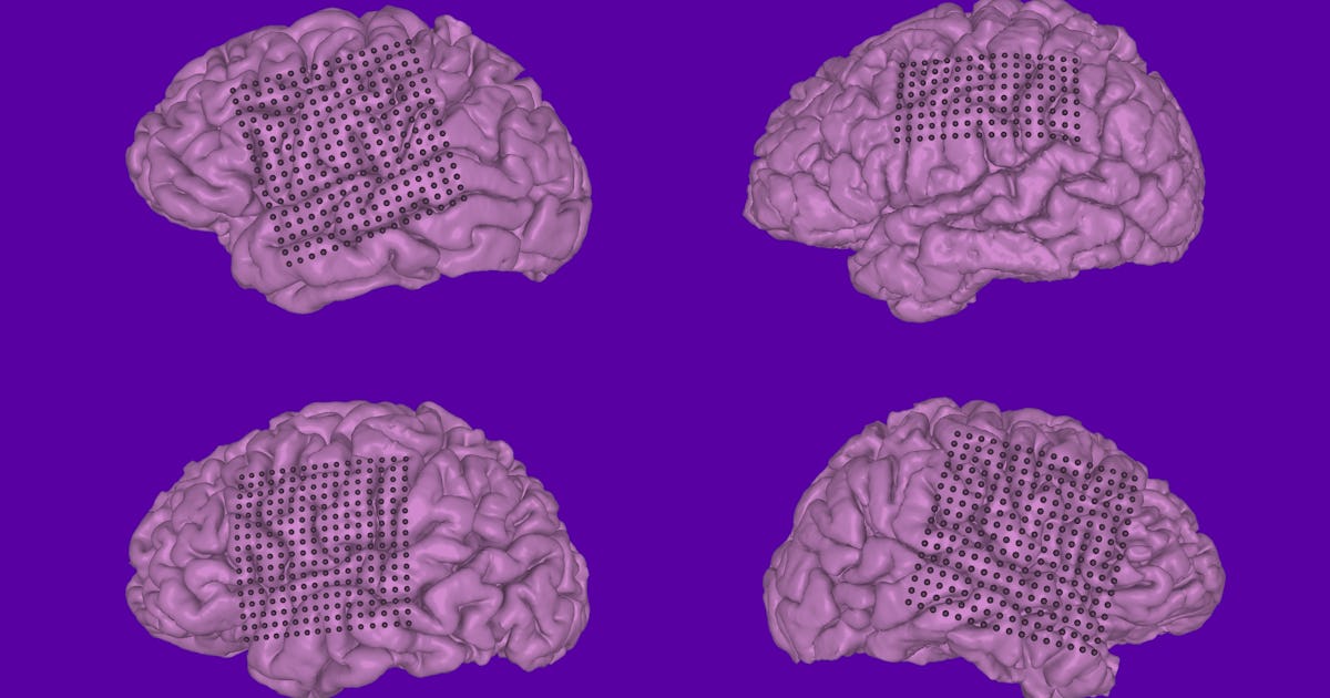 Neuroprosthetics: Doctors Decode Human Speech From Brain Signals