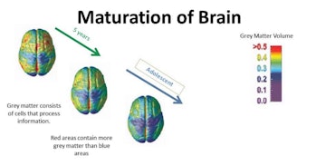 brain development grey matter teenagers