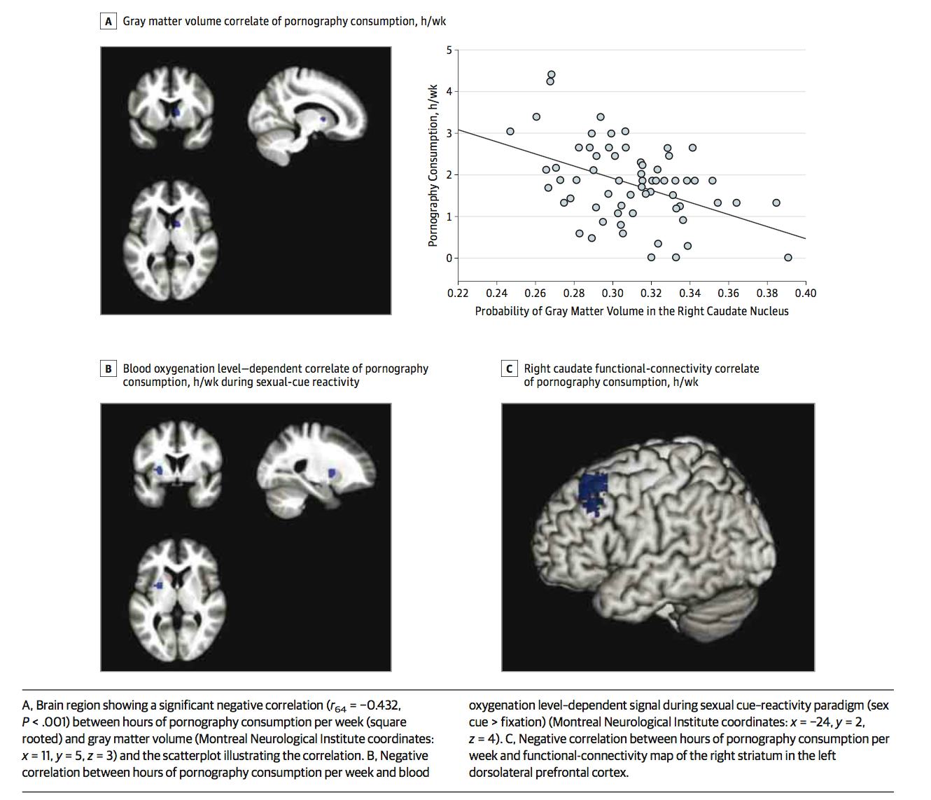 Neuroscience Reveals How the Brain Changes as It Watches Porn