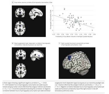 brain images porn