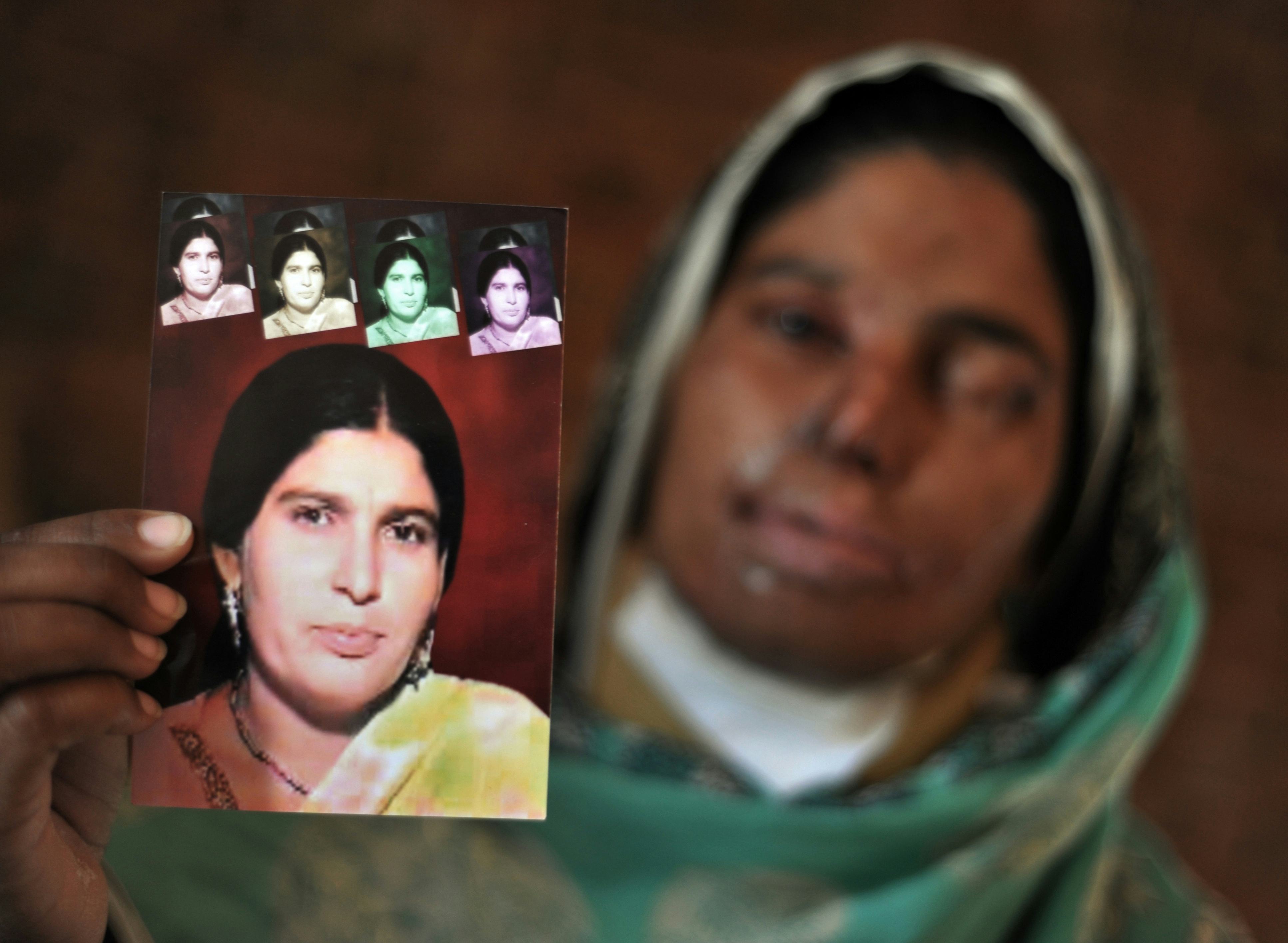 How To Help Acid Attack Victims Heal By Spreading Awareness And Acceptance
