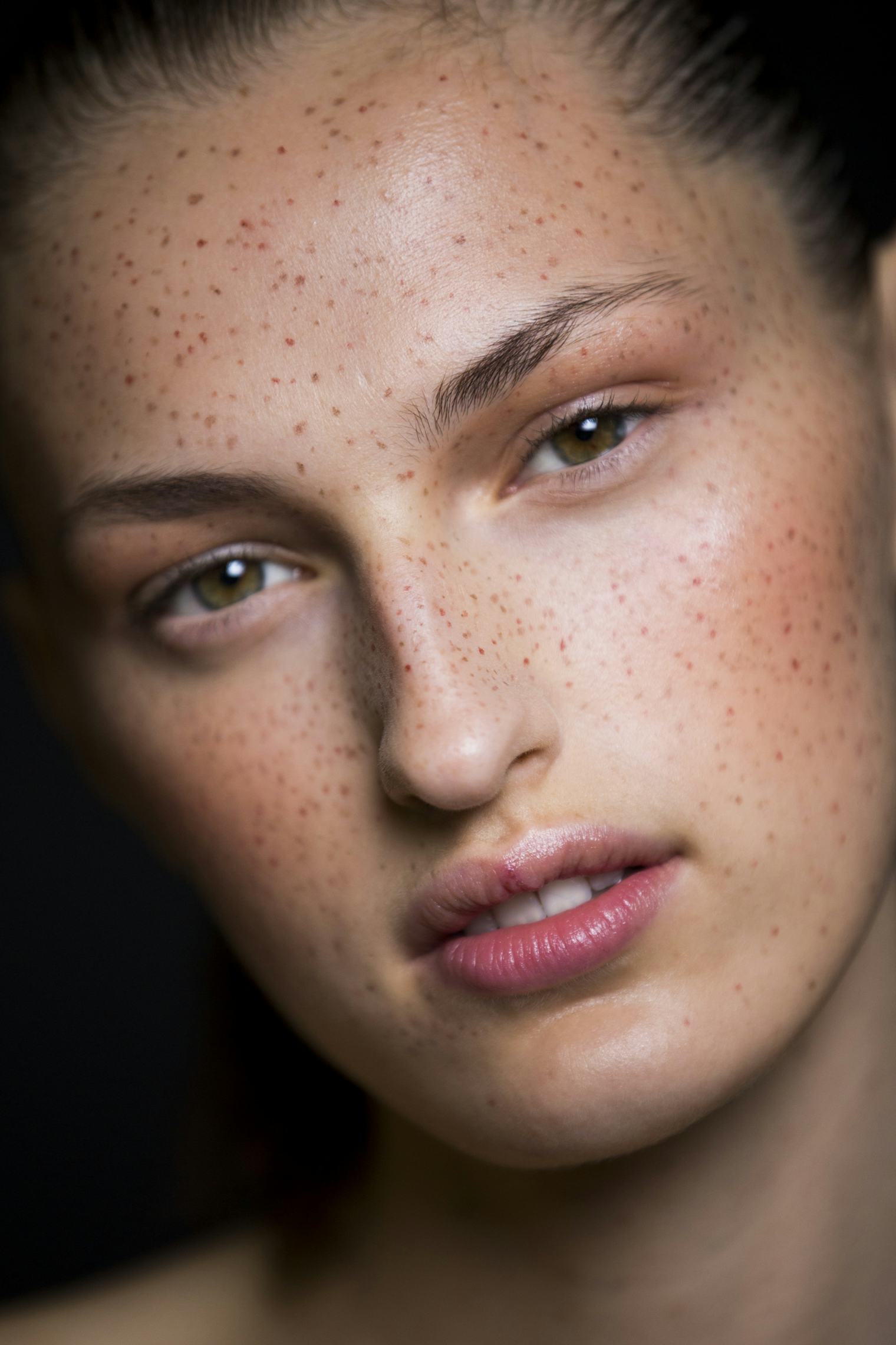 7 Reasons To Love Your Freckles Immediately — Theyre A Form Of Entertainment After All 