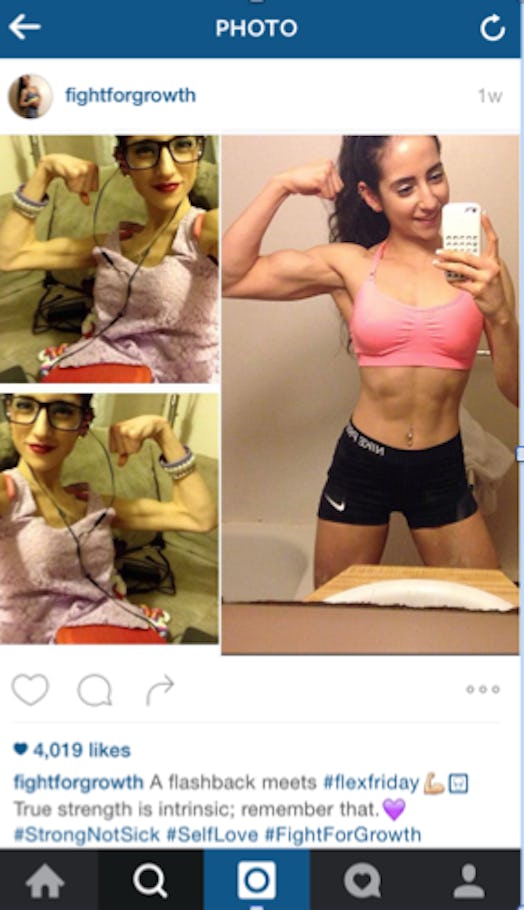 A woman with eating disorder before and after weightlifting