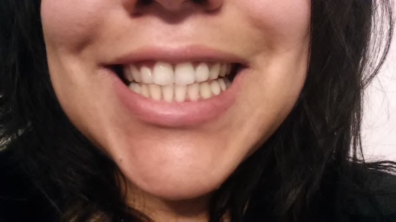 Does Activated Charcoal Whiten Teeth? I Brushed With It For A Week