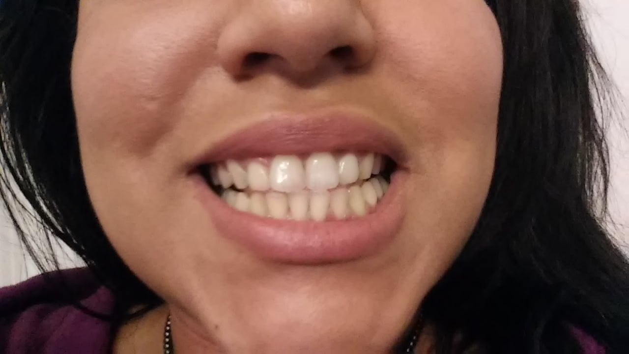 Does Activated Charcoal Whiten Teeth? I Brushed With It For A Week & Here's What Happened