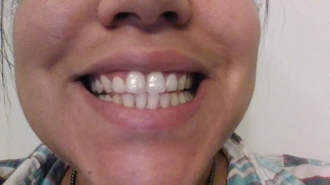 Does Activated Charcoal Whiten Teeth? I Brushed With It For A Week