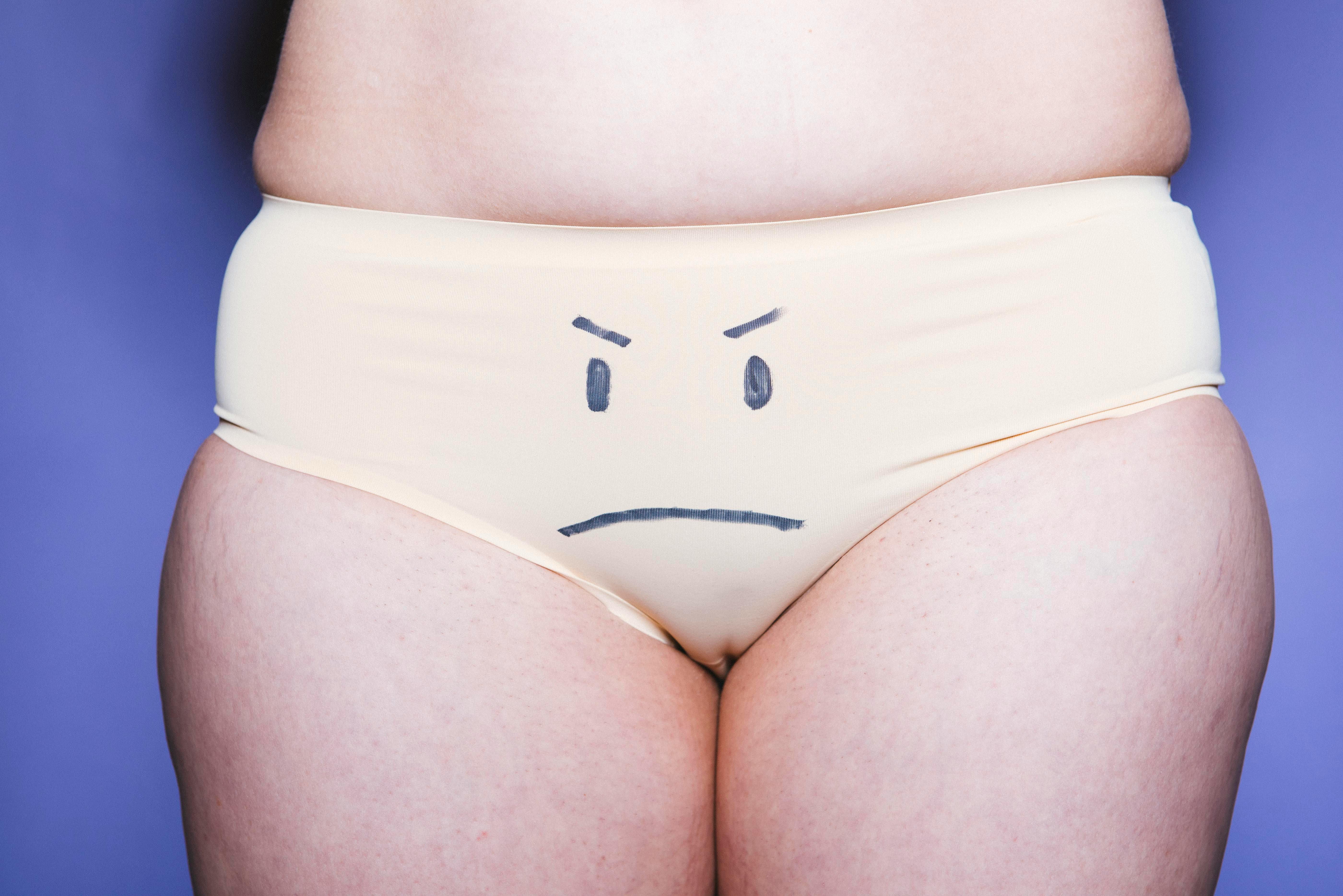 Should You Pluck An Ingrown Hair With Tweezers? Read These Words of