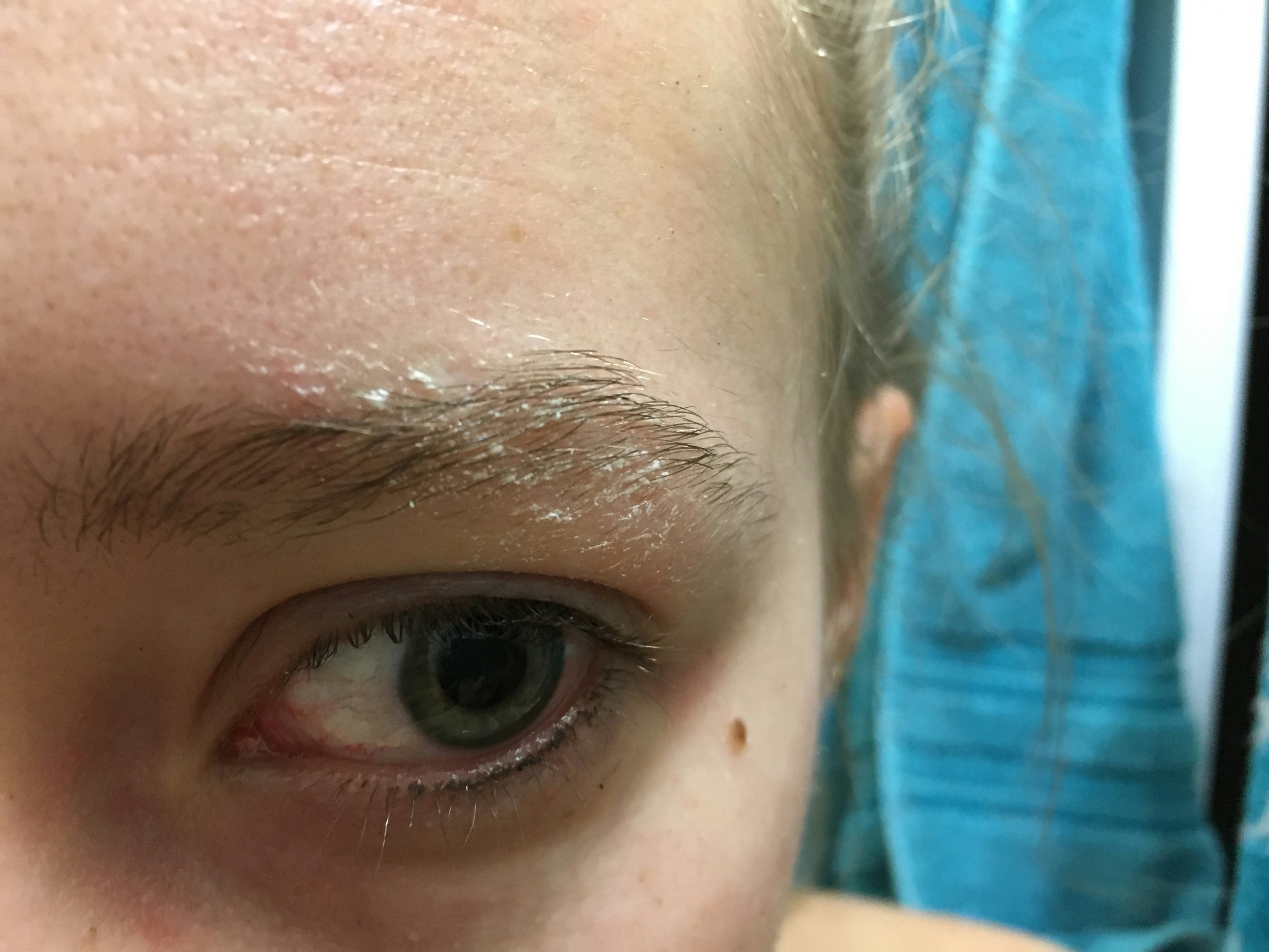 I Tried Every Eye DePuffing Hack Out There & This Is What Happened