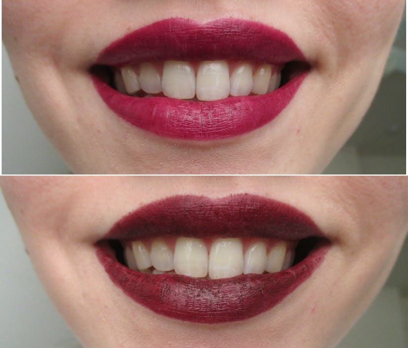 What Color Lipstick Makes Teeth Look Whiter A Handy Guide To Getting Your Most Brilliant Smile