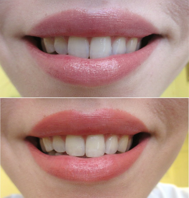 Lipstick to make your teeth look whiter Lipstick to make your teeth look whiter