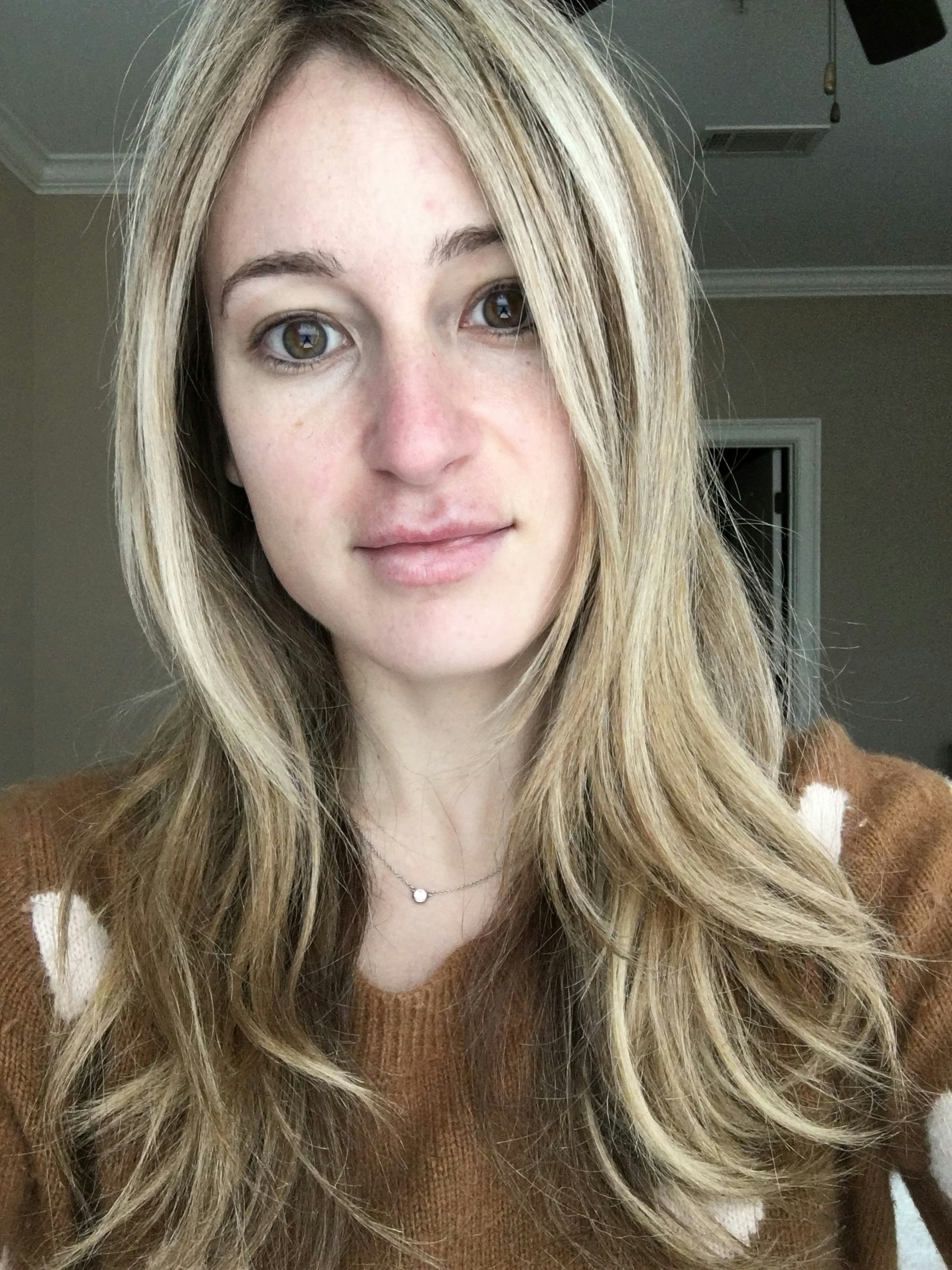 I Used Face Oil Instead Of Moisturizer For A Week & Here's What