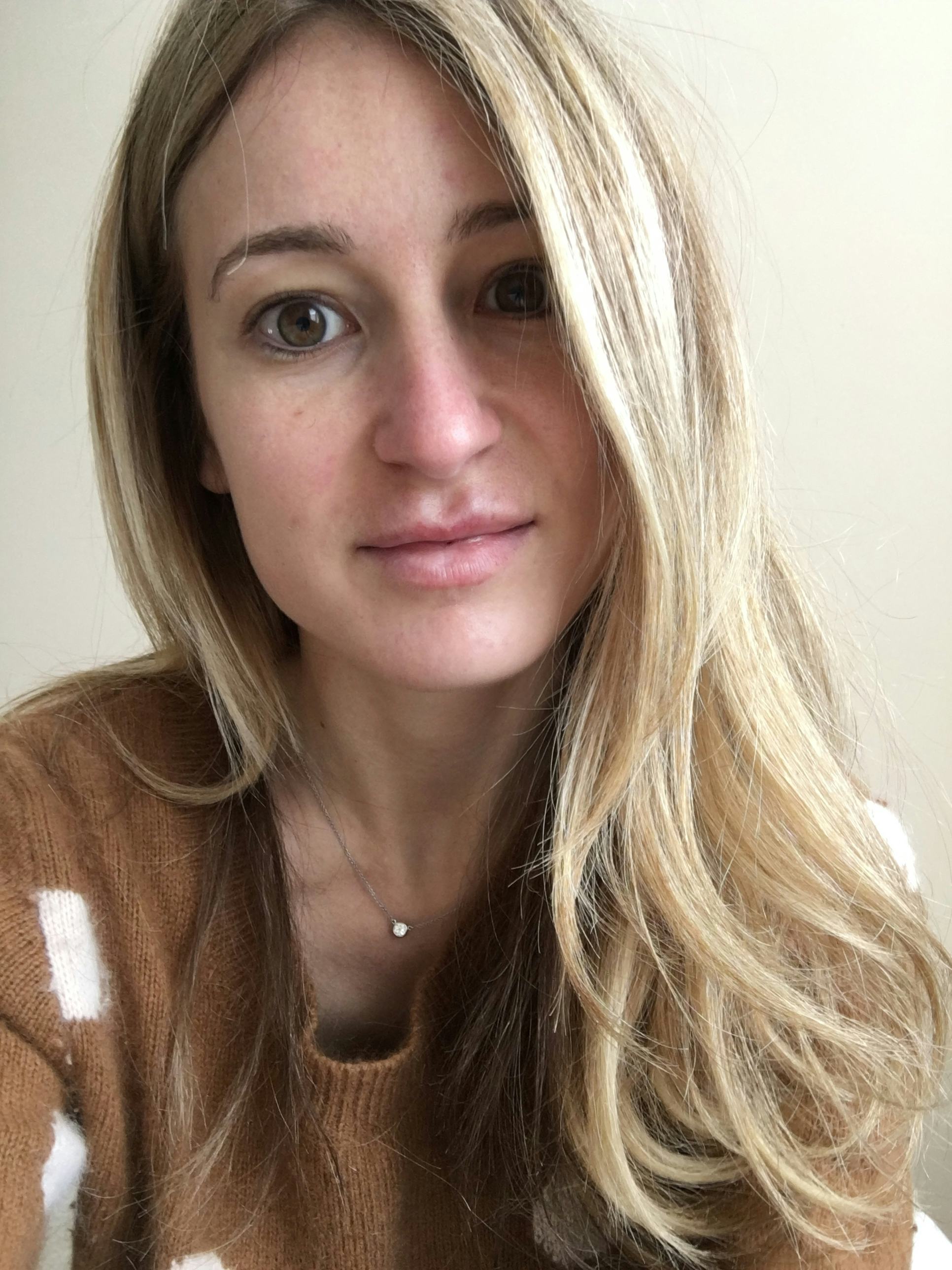 I Used Face Oil Instead Of Moisturizer For A Week & Here's What