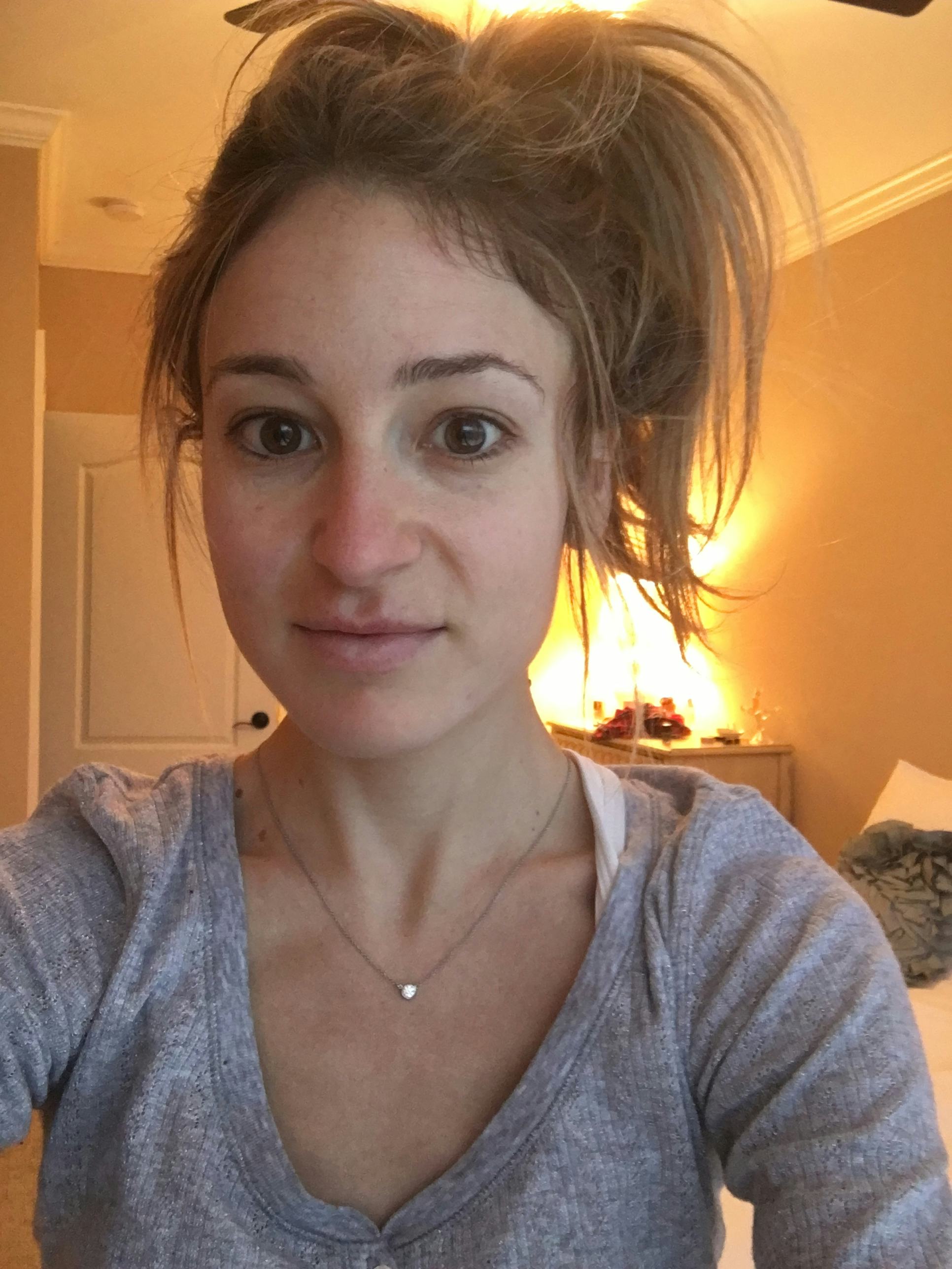 I Used Face Oil Instead Of Moisturizer For A Week & Here's What