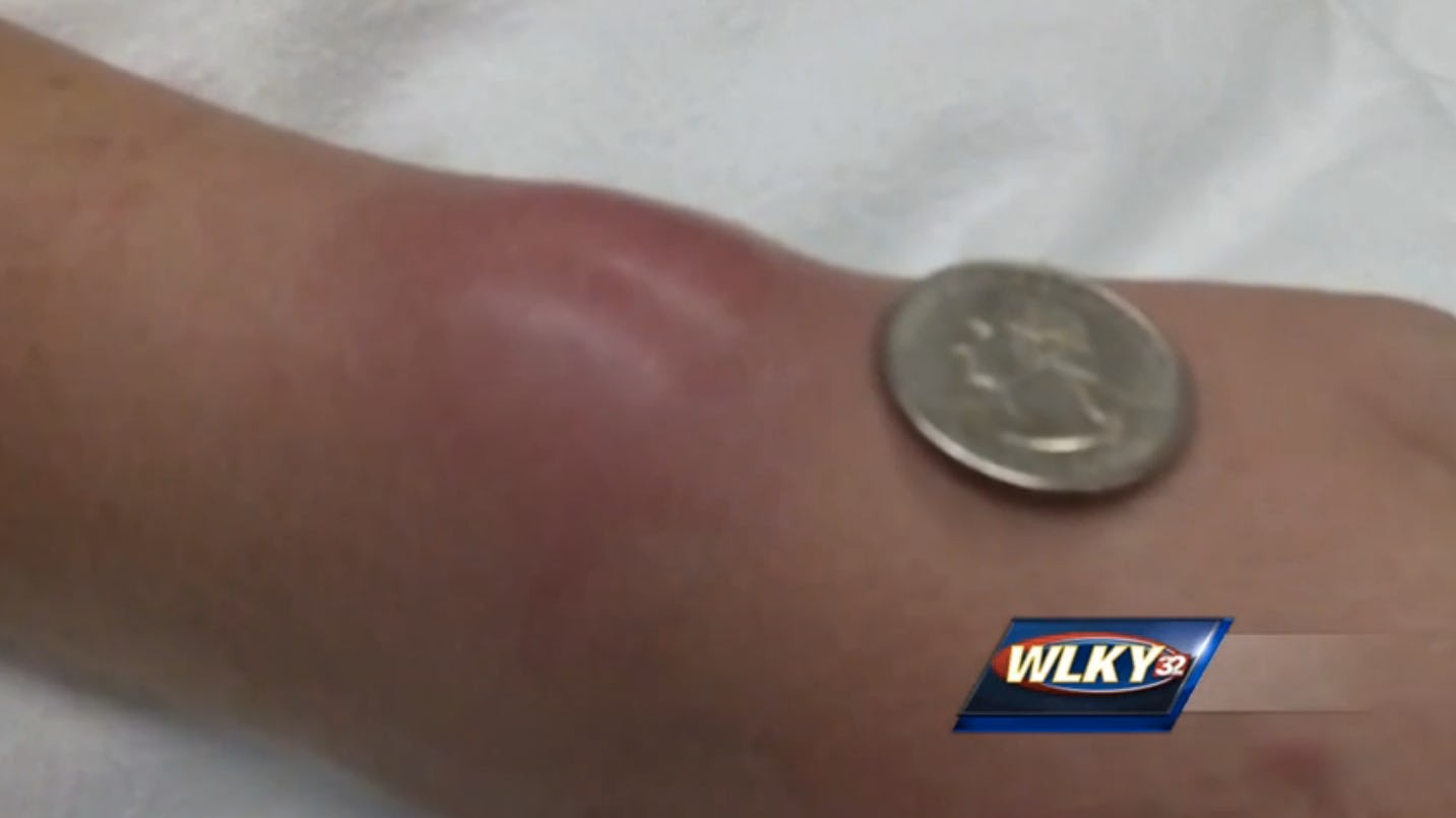 This PSA About The Potential Danger Of Wearing A Hair Tie On Your Wrist