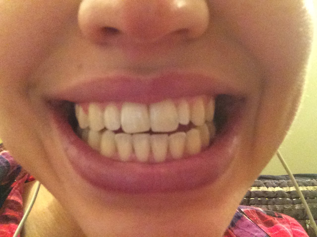 Does Oil Pulling Work To Whiten Your Teeth? I Tried It For a Week, and