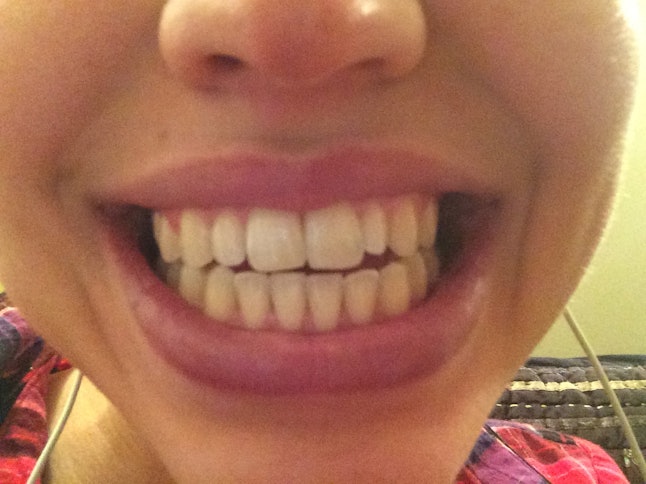 Does Oil Pulling Work To Whiten Your Teeth? I Tried It For a Week, and Here's What Happened