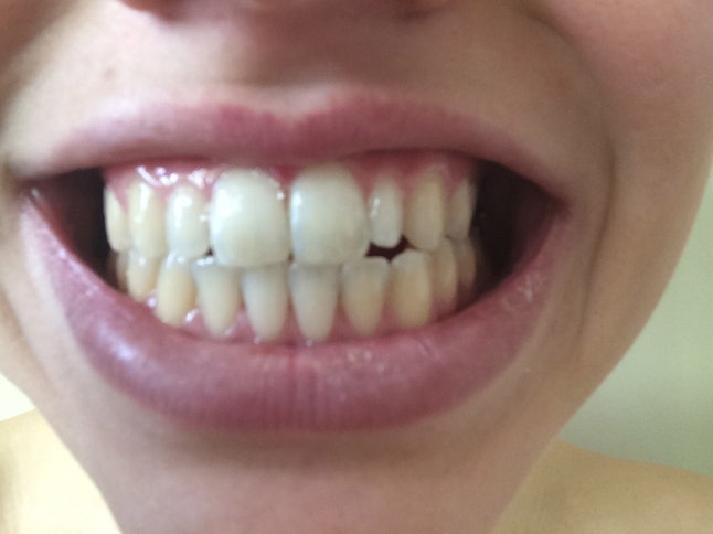 How to whiten your teeth with coconut oil Does Oil Pulling Work To Whiten Your Teeth? I Tried It For a Week, and