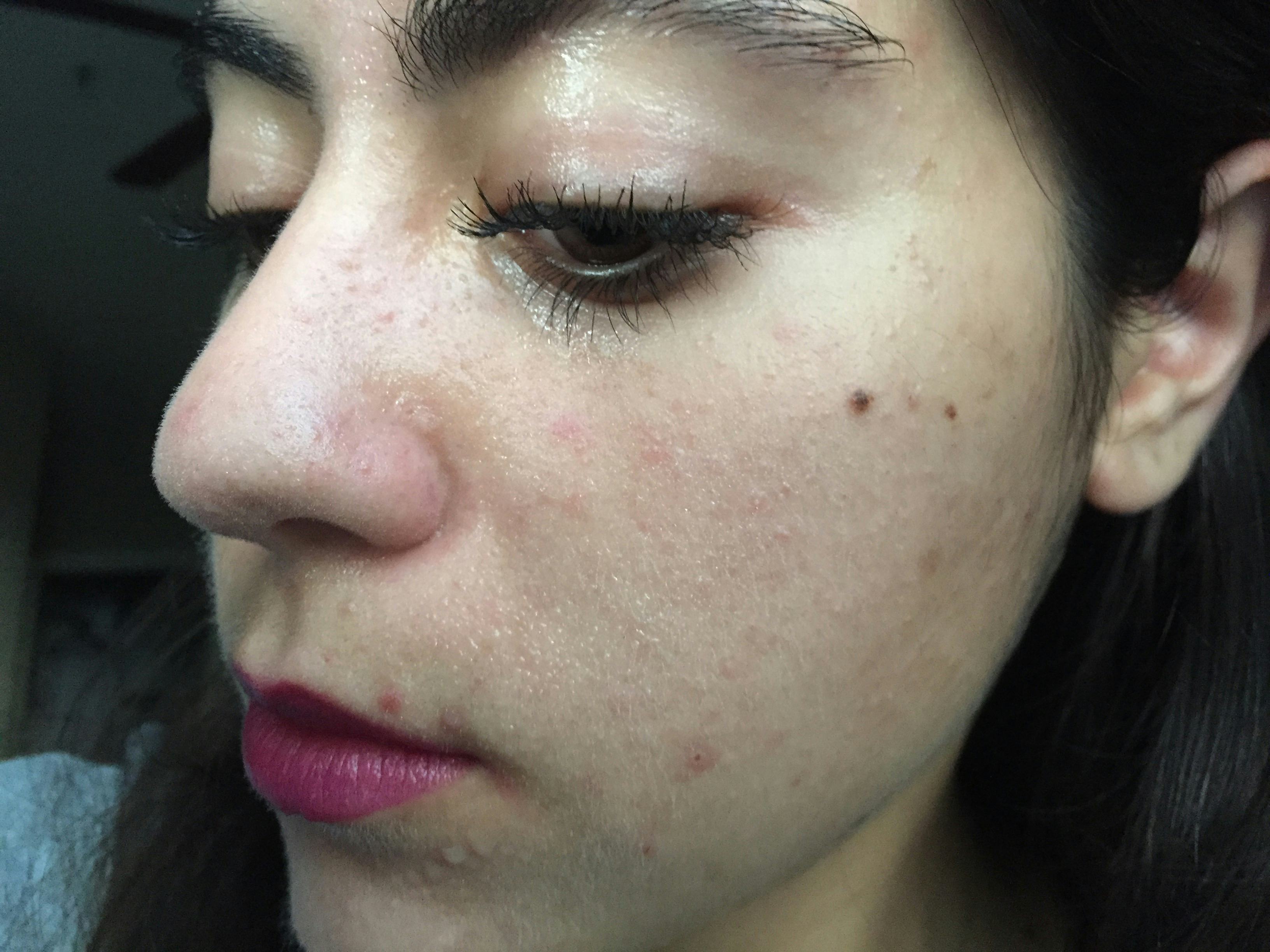 I Tried 6 Facial Sprays To Find Out Which Ones Are Most Refreshing