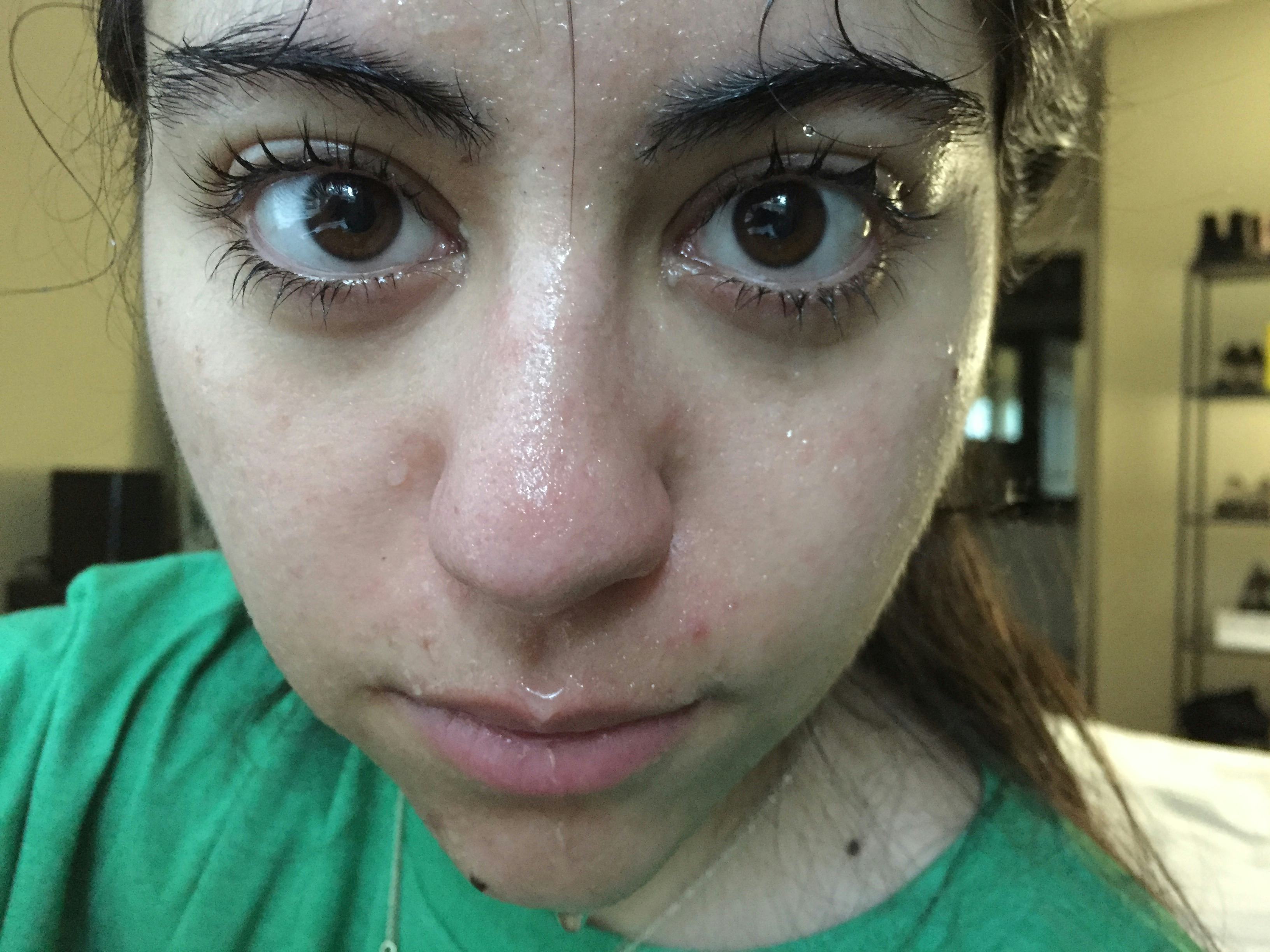 I Tried The Ice Water Facial & This Is What Happened