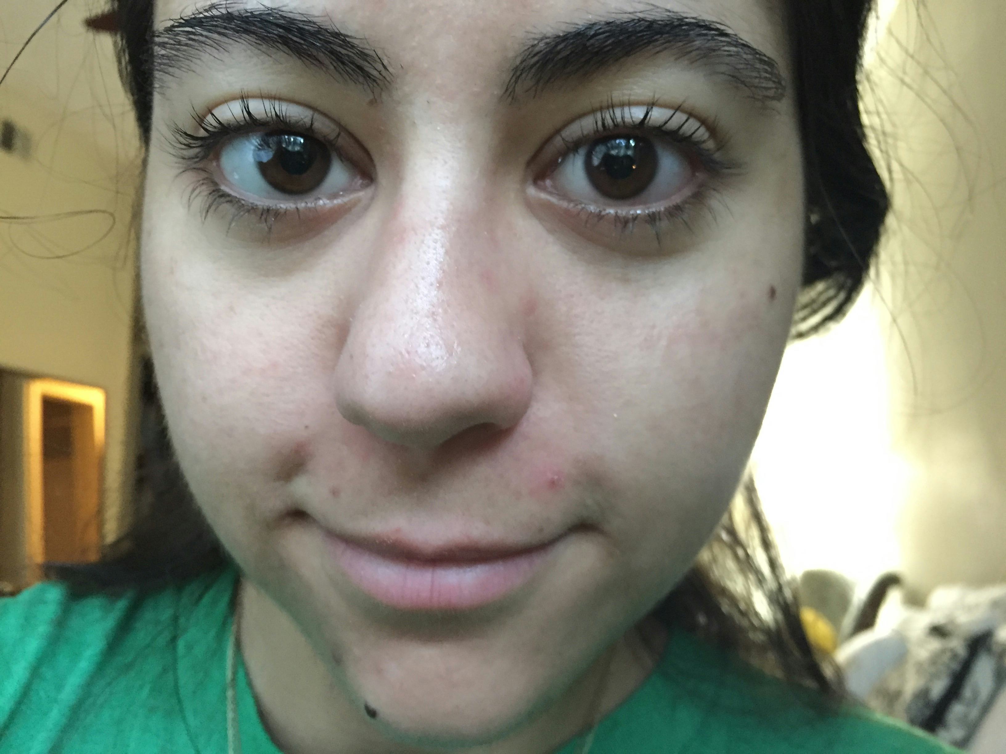 I Tried The Ice Water Facial & This Is What Happened