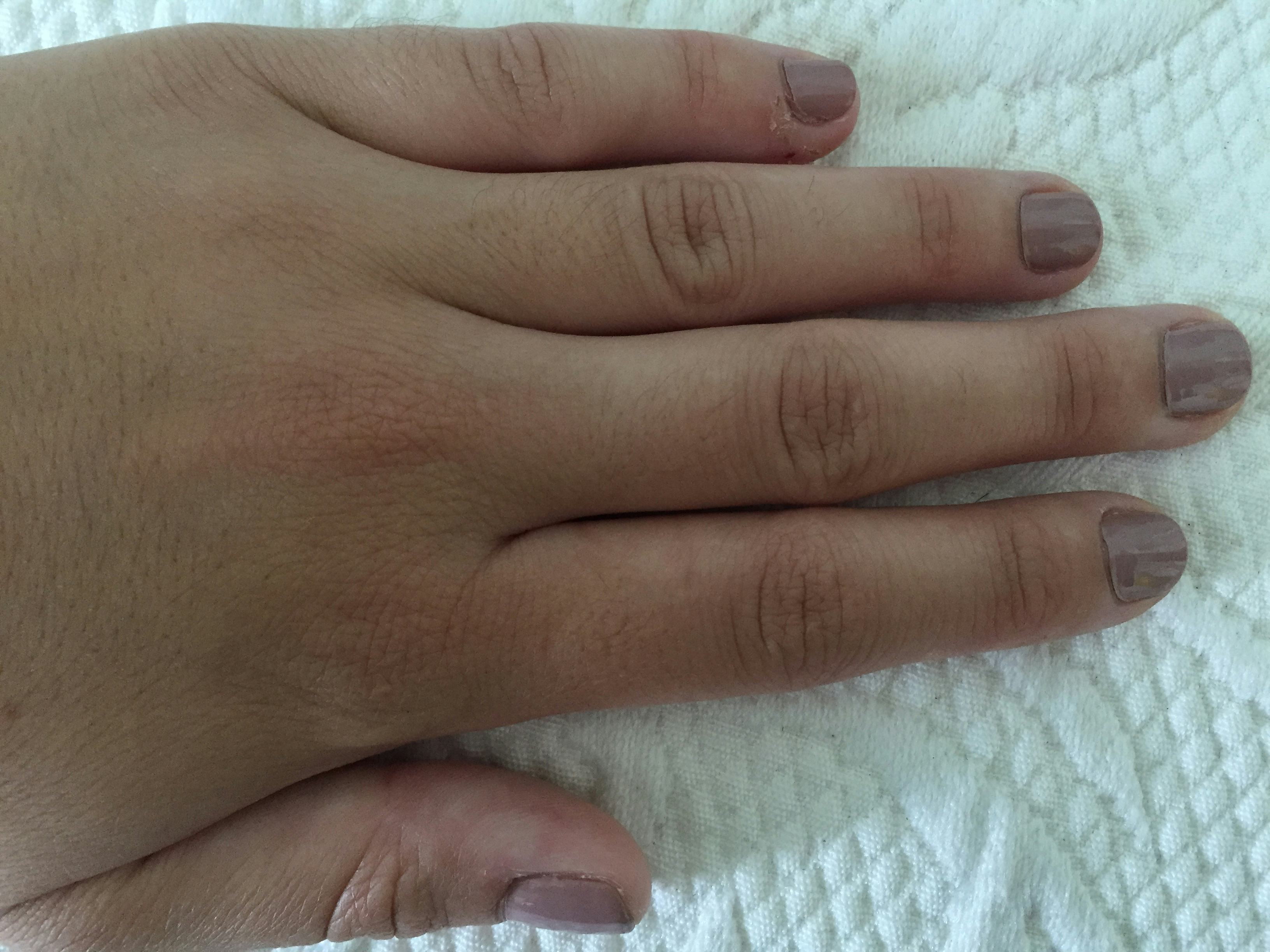 How Not Shaving My Hairy Hands Taught Me To Love Myself For Who I Am