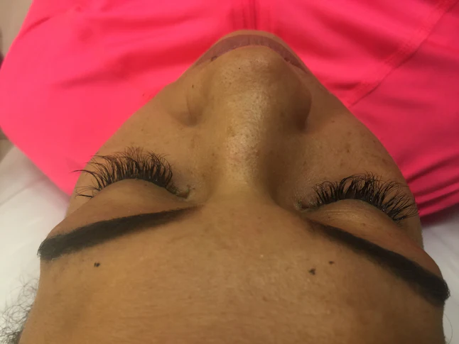 Do Eyelash Extensions Hurt Two Experts Weigh In On What To Watch Out For