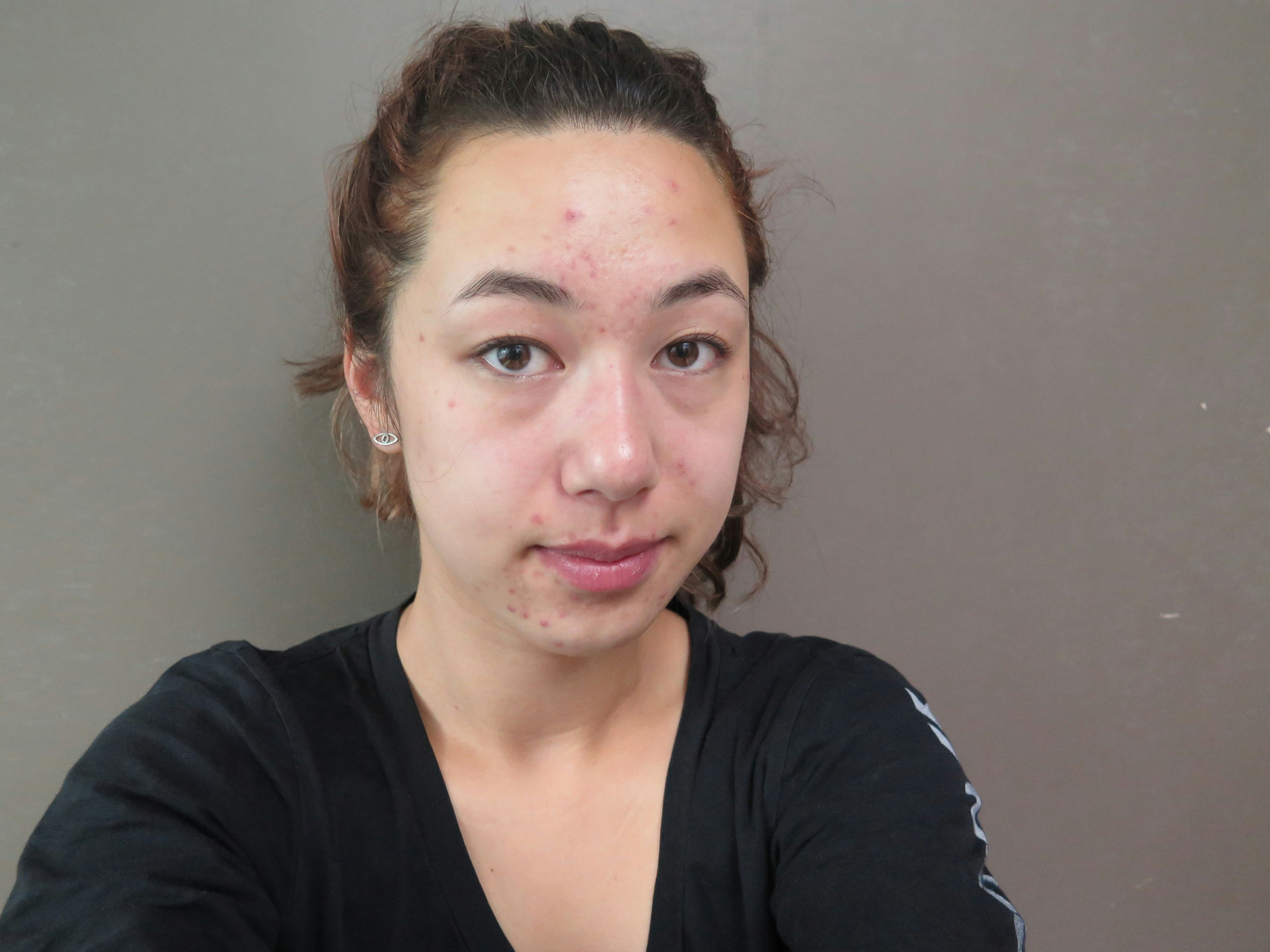 I Used Two Sheet Masks Every Day For A Week This Is What Happened Photos