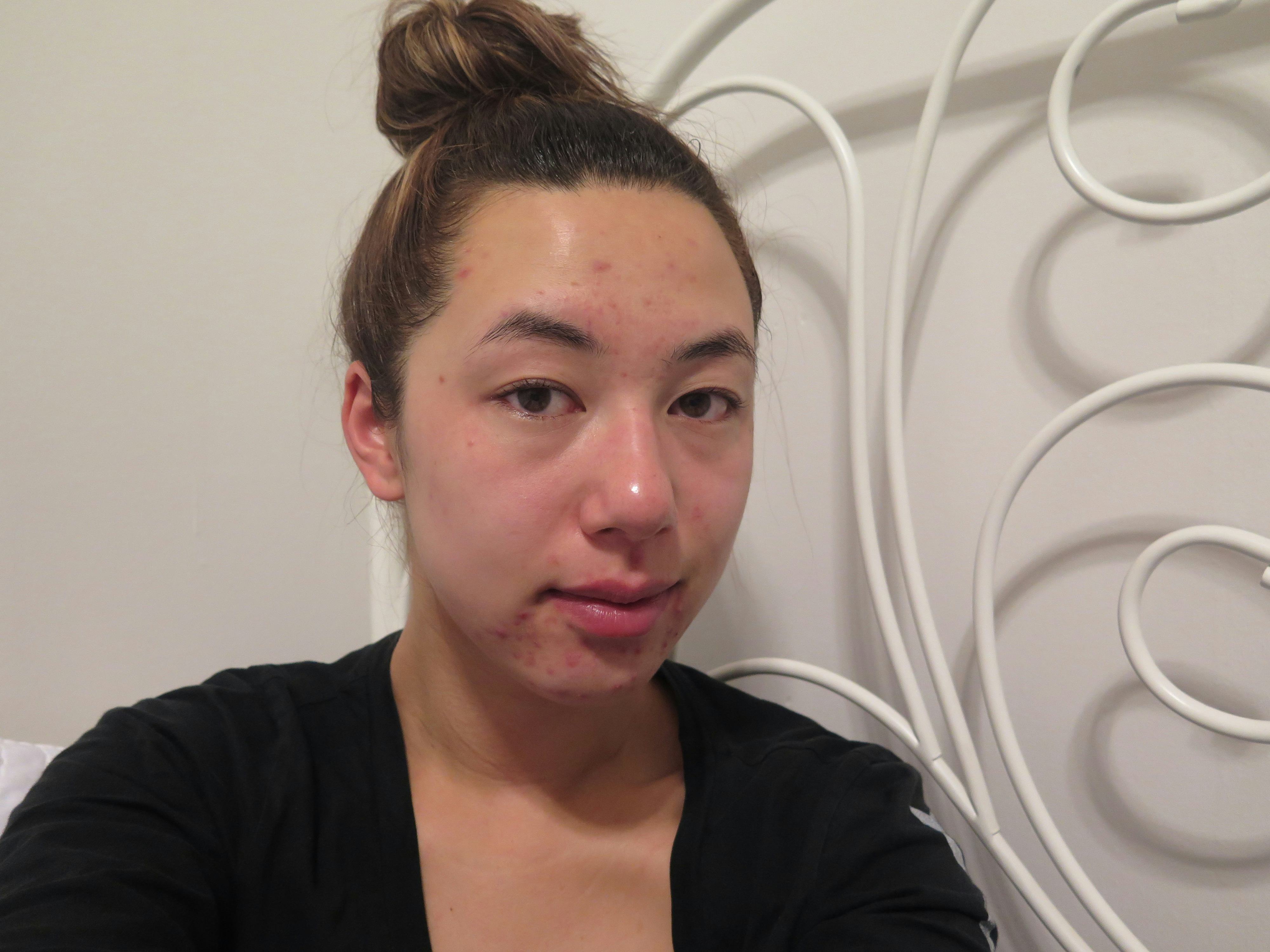 I Used Two Sheet Masks Every Day For A Week & This Is What Happened