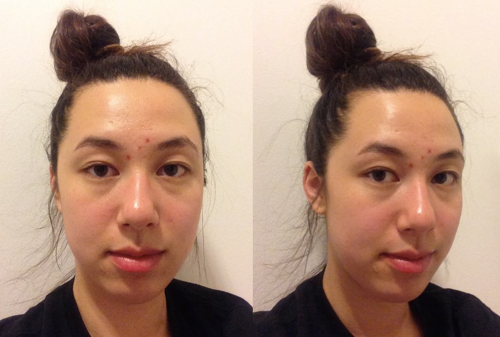 I Tried The 424 Cleansing Method For A Week To Get Skin As Clear As A