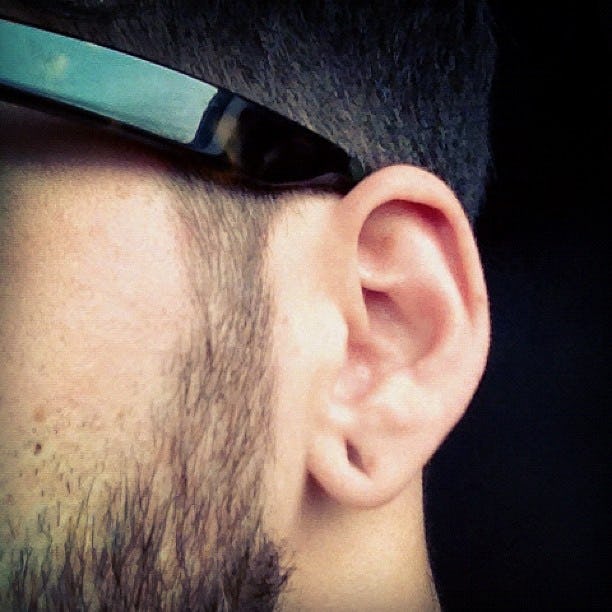 7 Ways To Close A Piercing Properly With As Little Scarring As Possible