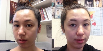 Before and after pictures of woman's skin when she drinks more water