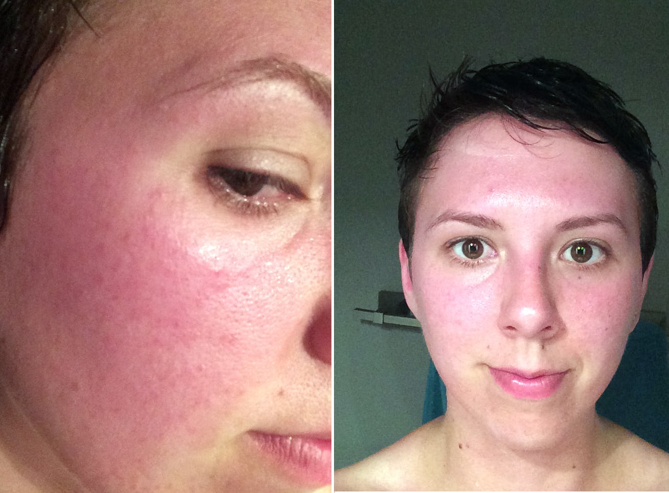 Wash Your Face With Yogurt And Your Skin Will Thank You (Plus, It's Not