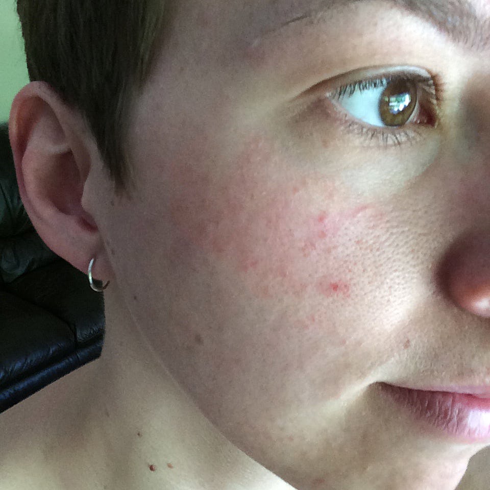 Wash Your Face With Yogurt And Your Skin Will Thank You (Plus, It's Not