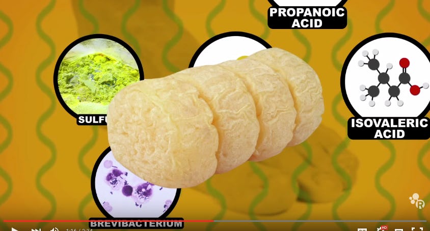 Why Do Your Feet Smell And What Can You Do About It? This Video Has The