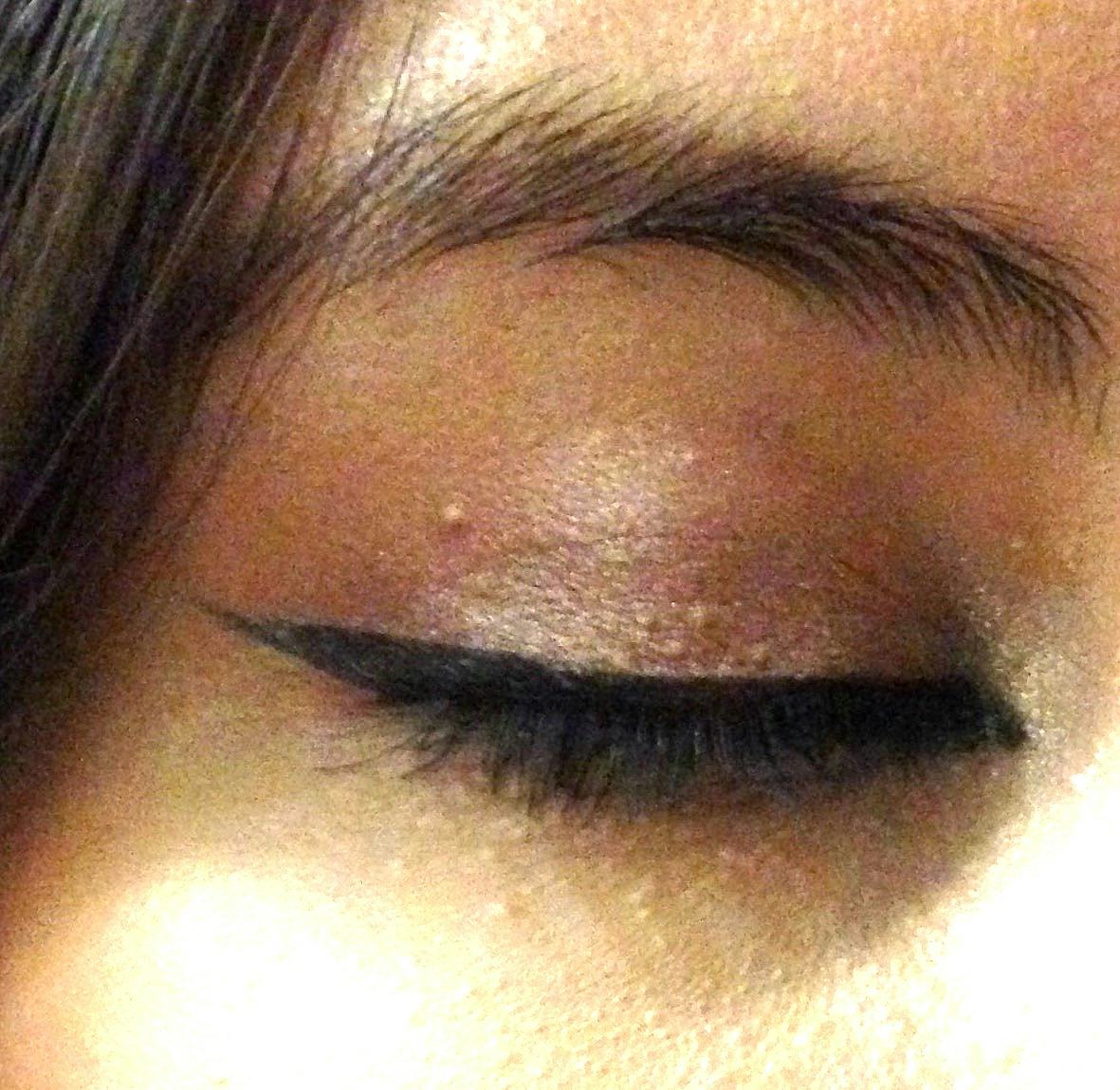 7 Things People With Milia Are Tired Of Hearing About Their "Baby Acne"