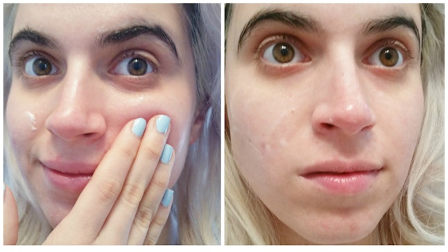 i used probiotics on