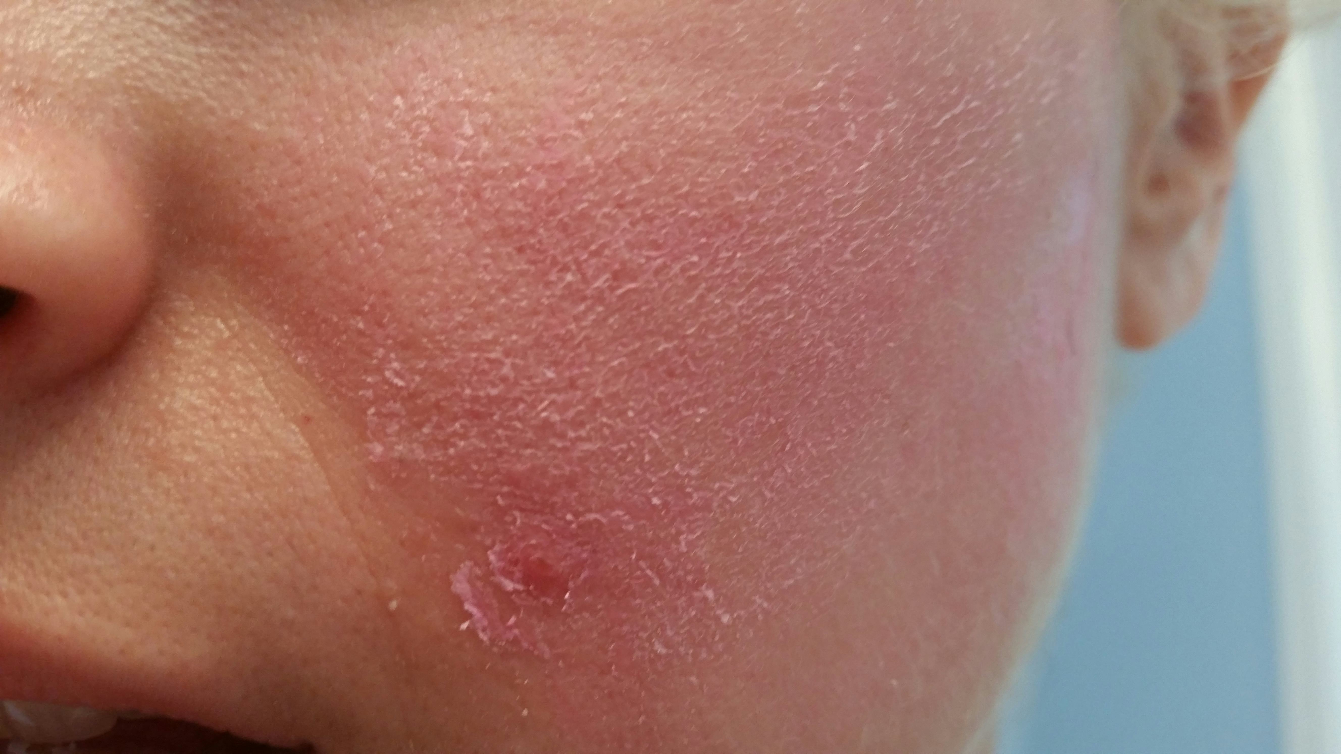 A Pepto Bismol Face Mask May Be The Prettiest Way To Tighten Your Pores