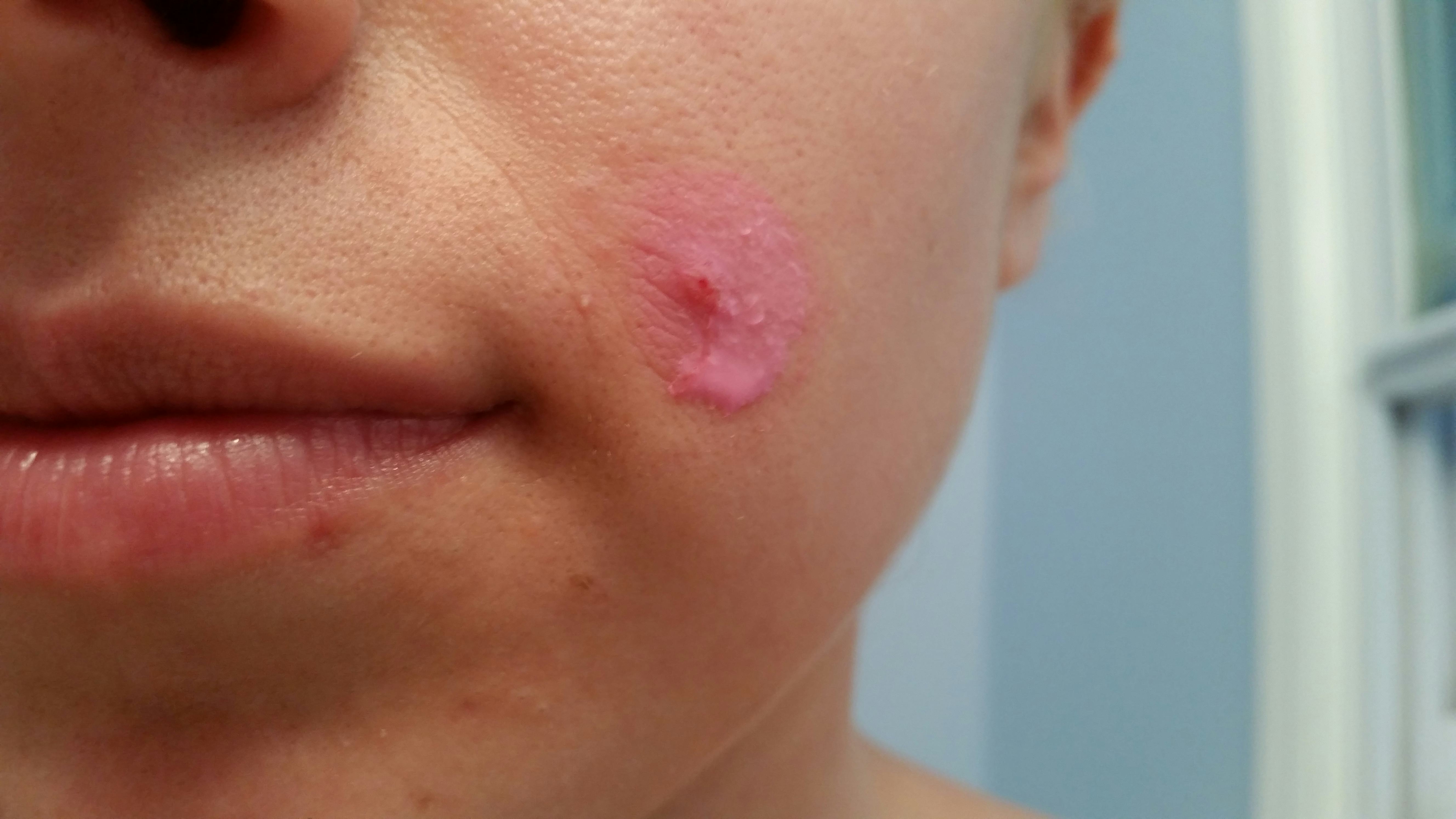 A Pepto Bismol Face Mask May Be The Prettiest Way To Tighten Your Pores