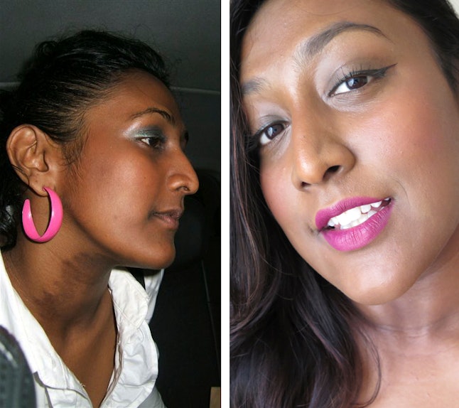 Use Coconut Oil For Eczema Treatment The Next Time You Have A Painful